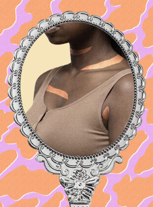 elle hiperpigmentacao racismo 1500x2000 1