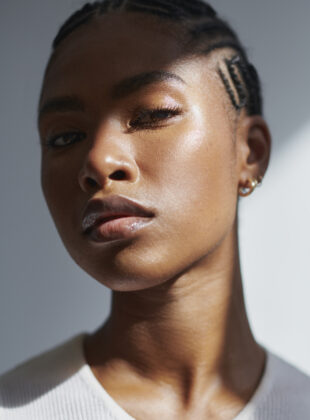 Botox preventivo: será que vale a pena investir? Botox preventivo