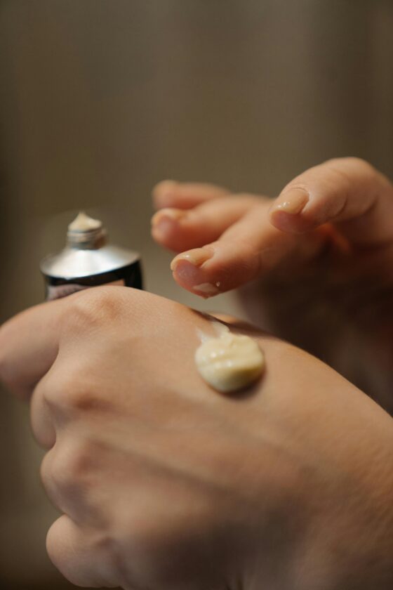 eczema ou psoríase