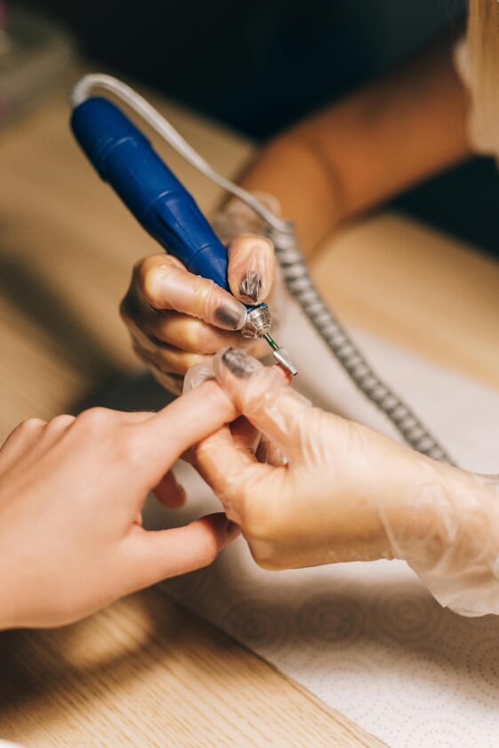 Alergia a unhas em gel: especialista alerta sobre os perigos para a saúde alergia a unhas em gel