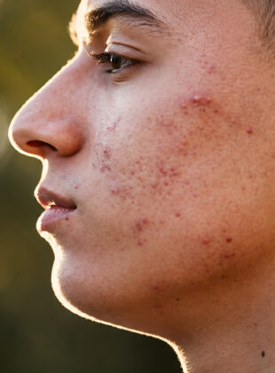 personagem scars of life6